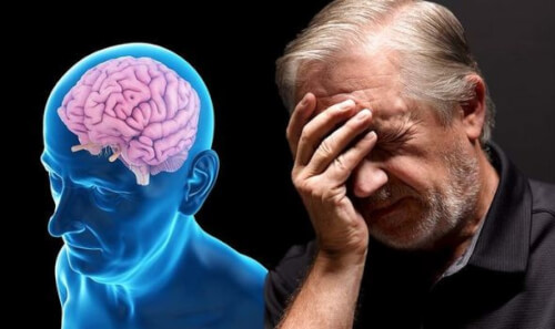 Bệnh Alzheimer là gì 3