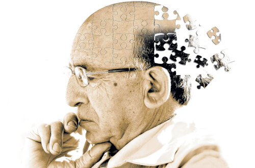 Bệnh Alzheimer là gì? 1