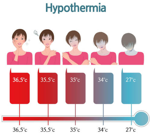 Hạ thân nhiệt là gì? 1
