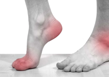 4 vấn đề cơ xương khớp thường gặp ở bàn chân khi về già 